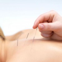 Acupuncture To the Rescue!